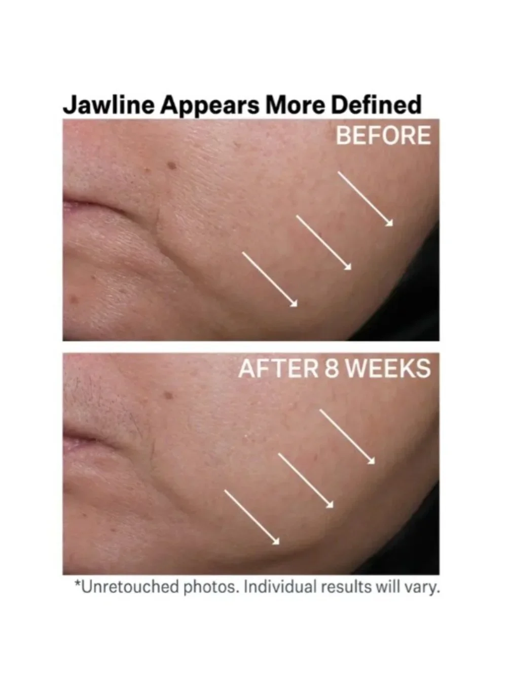 StriVectin contour restore
